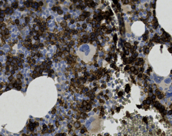 Tissue-Tek Genie<sup>®</sup><br /> anti-CD71 Tissue-Tek Genie<sup>®</sup><br /> anti-CD71