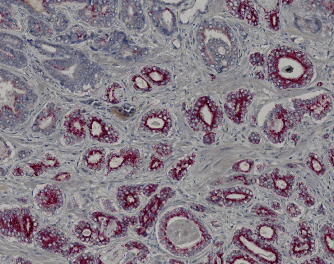 Tissue-Tek Genie<sup>®</sup> DUO<br /> anti-AMACR/p63/CK5/6 PIN Antibody Cocktail Tissue-Tek Genie<sup>®</sup> DUO<br /> anti-AMACR/p63/CK5/6 PIN Antibody Cocktail