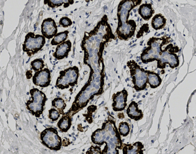 Tissue-Tek Genie<sup>&reg;</sup><br /> anti-Myosin Smooth Muscle