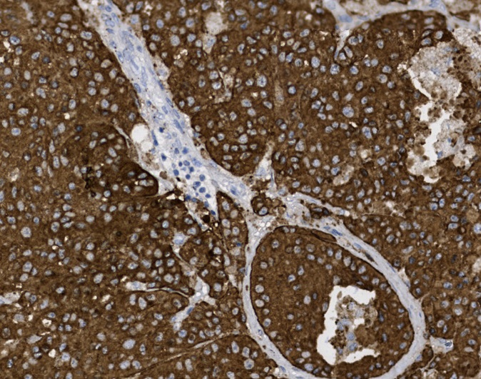 Tissue-Tek Genie<sup>®</sup><br /> anti-Melan-A Tissue-Tek Genie<sup>®</sup><br /> anti-Melan-A