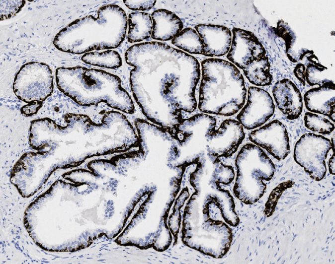 Tissue-Tek Genie<sup>®</sup><br /> anti-Cytokeratin 5/6 Tissue-Tek Genie<sup>®</sup><br /> anti-Cytokeratin 5/6