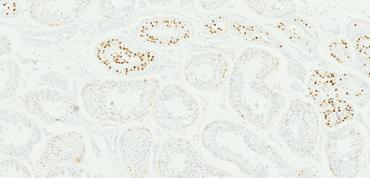 Tissue-Tek Genie anti-SALL4