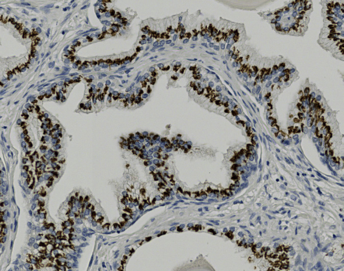 Tissue-Tek Genie<sup>®</sup><br /> anti-Prostein Tissue-Tek Genie<sup>®</sup><br /> anti-Prostein