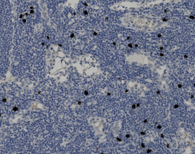 Tissue-Tek Genie<sup>®</sup><br /> anti-IgG4 Tissue-Tek Genie<sup>®</sup><br /> anti-IgG4