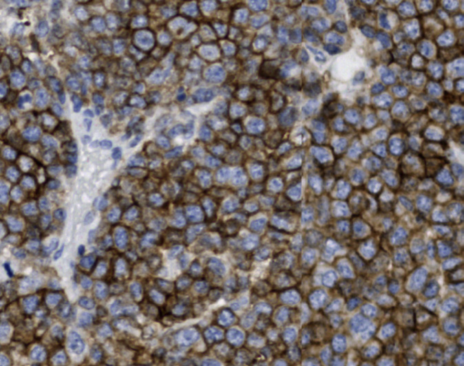 Tissue-Tek Genie<sup>®</sup><br /> anti-CD38 Tissue-Tek Genie<sup>®</sup><br /> anti-CD38