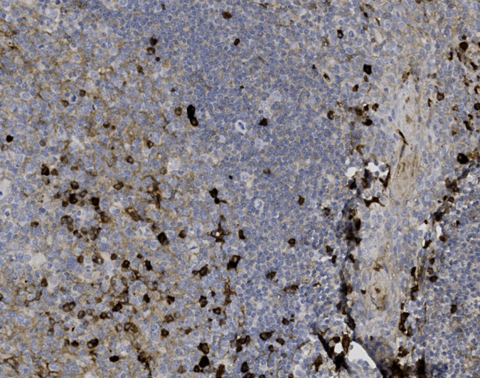 Tissue-Tek Genie<sup>®</sup><br /> anti-IgG Tissue-Tek Genie<sup>®</sup><br /> anti-IgG