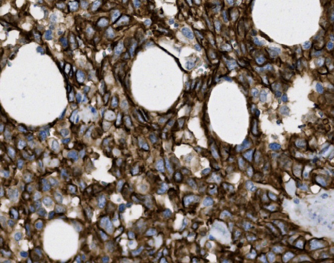 Tissue-Tek Genie<sup>®</sup> <br /> anti-CD31 Tissue-Tek Genie<sup>®</sup> <br /> anti-CD31