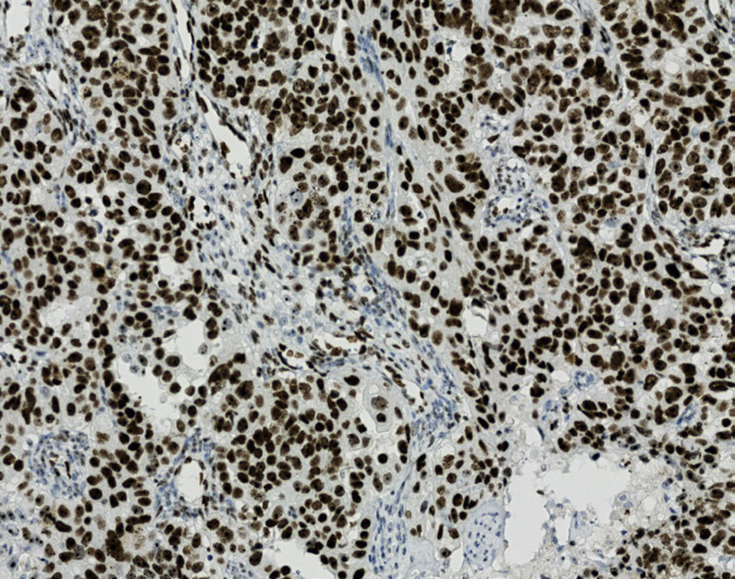 Tissue-Tek Genie<sup>®</sup><br /> anti-WT1 Tissue-Tek Genie<sup>®</sup><br /> anti-WT1