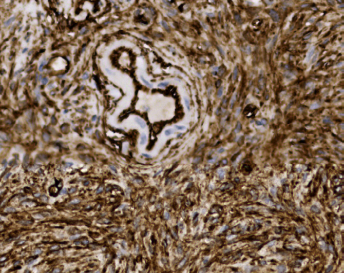 Tissue-Tek Genie<sup>®</sup><br /> anti-CD34 Tissue-Tek Genie<sup>®</sup><br /> anti-CD34