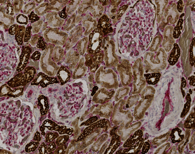 Tissue-Tek Genie<sup>&reg;</sup> DUO<br /> anti-Pan Cytokeratin/CD31 Antibody Cocktail