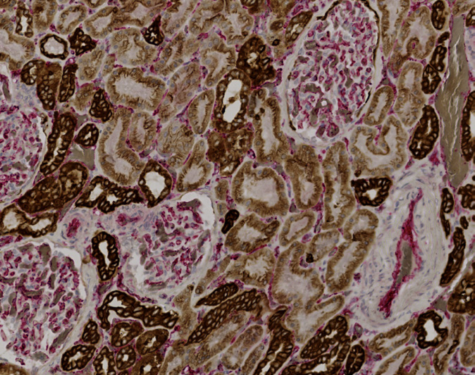 Tissue-Tek Genie<sup>®</sup> DUO<br /> anti-Pan Cytokeratin/CD31 Antibody Cocktail Tissue-Tek Genie<sup>®</sup> DUO<br /> anti-Pan Cytokeratin/CD31 Antibody Cocktail
