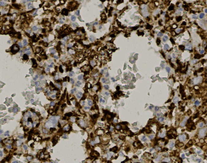 Tissue-Tek Genie<sup>®</sup><br /> anti-CD68 Tissue-Tek Genie<sup>®</sup><br /> anti-CD68