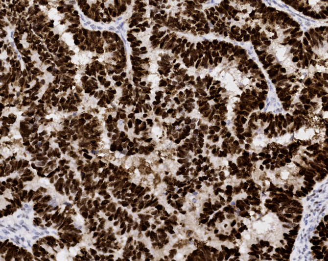 Tissue-Tek Genie anti-p53
