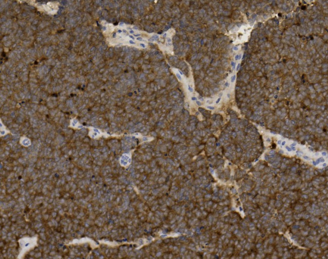Tissue-Tek Genie<sup>®</sup><br /> anti-Neuron Specific Enolase Tissue-Tek Genie<sup>®</sup><br /> anti-Neuron Specific Enolase