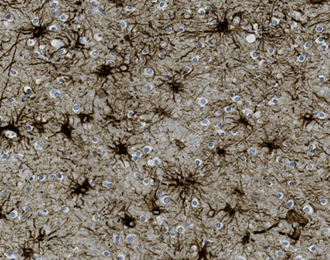 Tissue-Tek Genie<sup>®</sup><br /> anti-Glial Fibrillary Acidic Protein (GFAP) Tissue-Tek Genie<sup>®</sup><br /> anti-Glial Fibrillary Acidic Protein (GFAP)