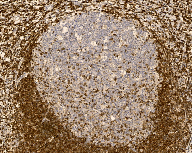 Tissue-Tek Genie<sup>®</sup><br /> anti-BCL2 Tissue-Tek Genie<sup>®</sup><br /> anti-BCL2