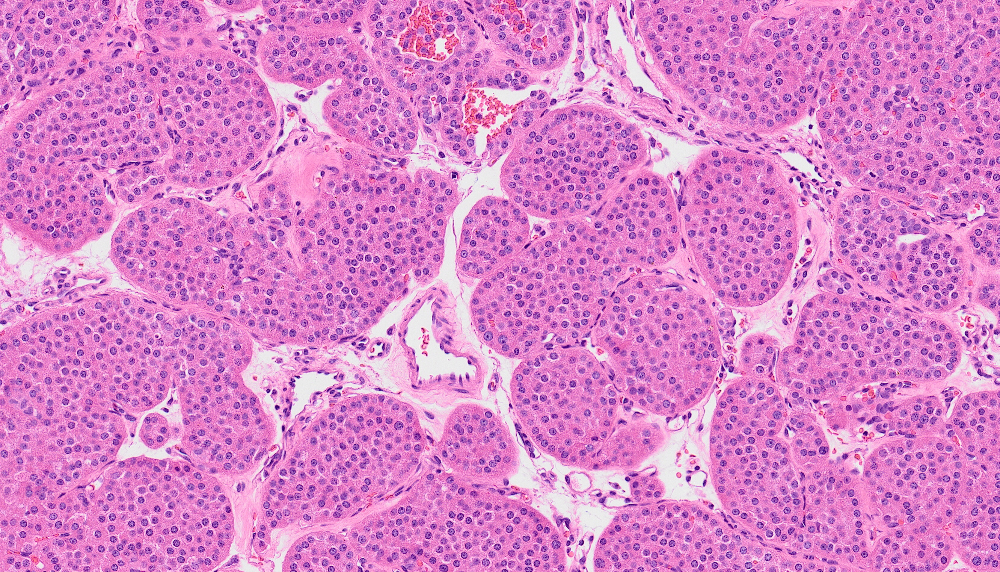 Microscopic view of kidney tissue stained with hematoxylin and eosin, showing renal tubules and glomeruli with densely packed cells.