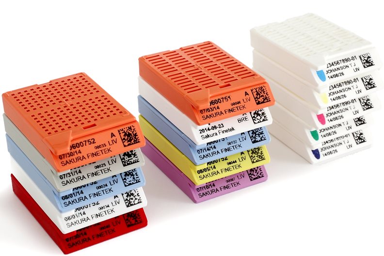 Stacks of multicolored plastic biopsy cassettes with printed and labeled information on the sides, used for organizing and identifying tissue samples in medical laboratories.