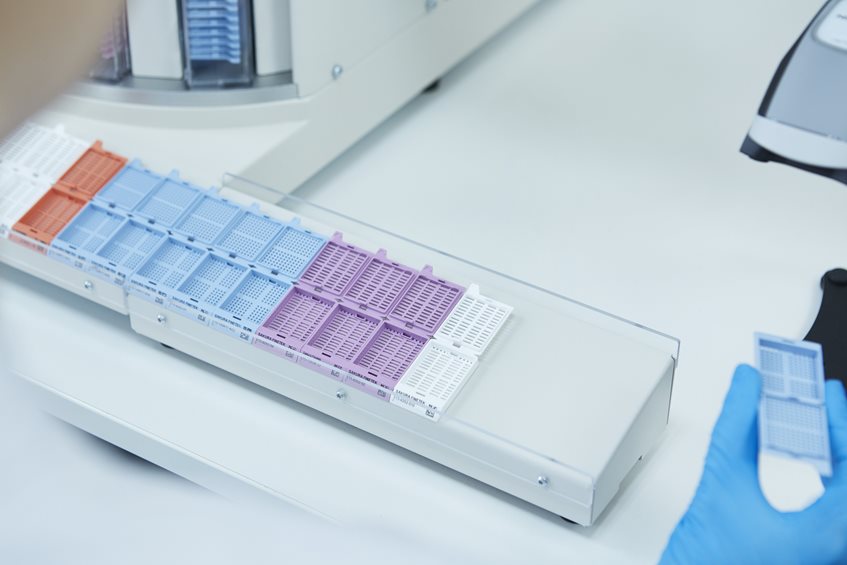 A row of color-coded tissue cassettes sits on a laboratory machine, with a gloved hand holding one cassette in the foreground.