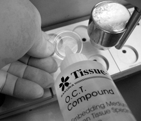 A hand holds a container while dispensing O.C.T. Compound tissue embedding medium onto a laboratory tray.