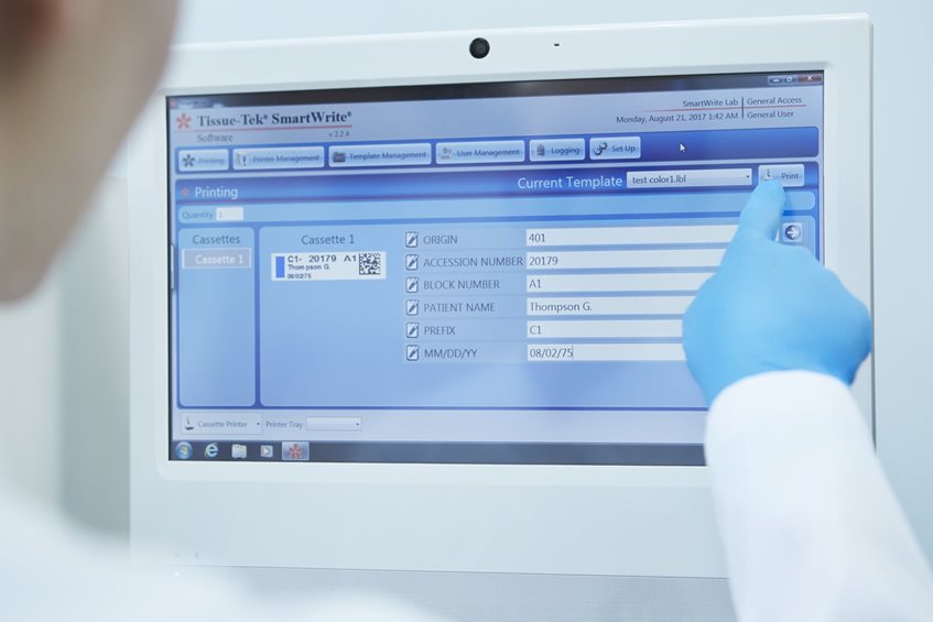 A gloved hand points at a touchscreen displaying tissue sample labeling and management software on a computer monitor.