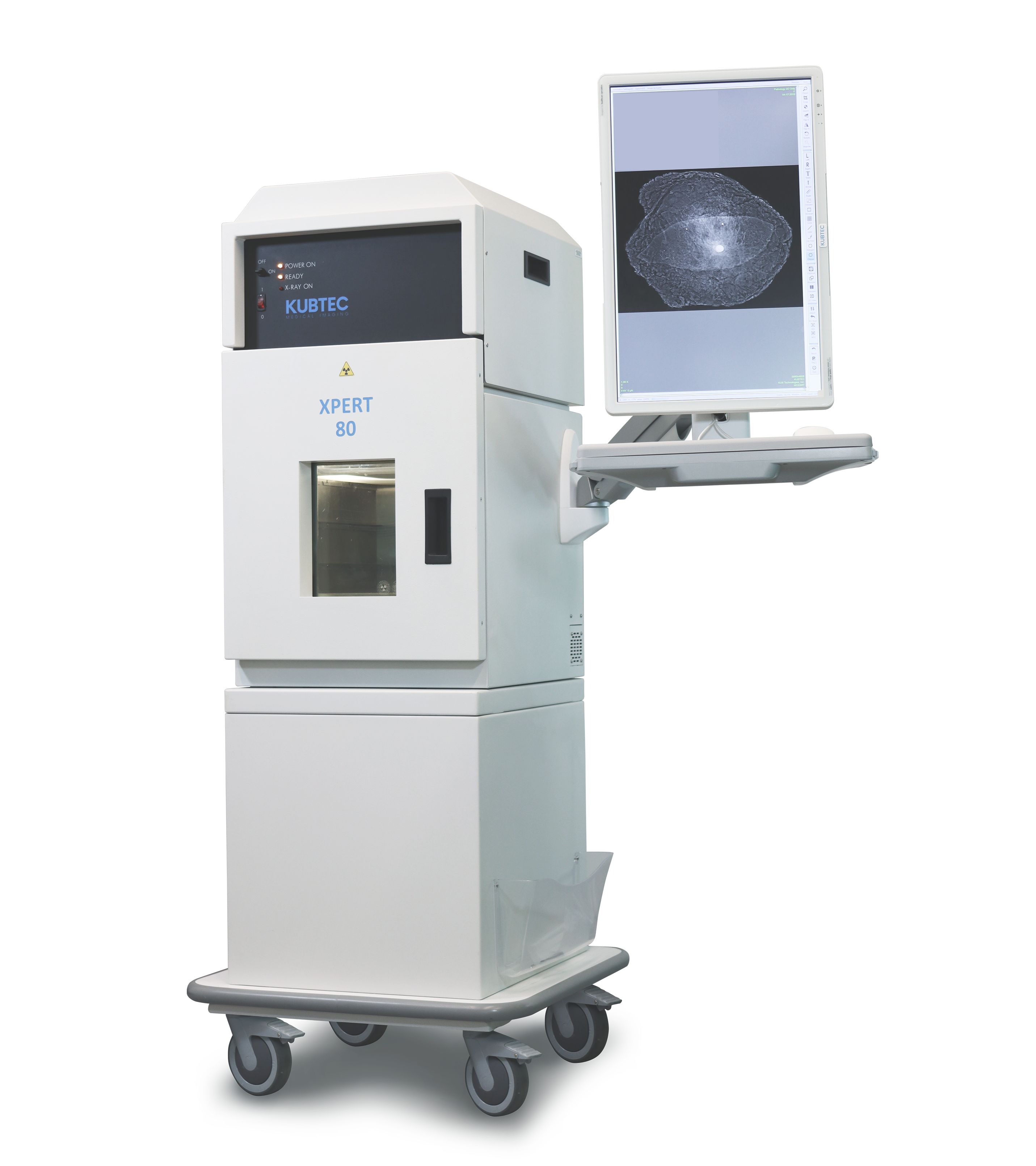 A KUBTEC XPERT 80 medical imaging machine on wheels with a monitor displaying a grayscale scan image.