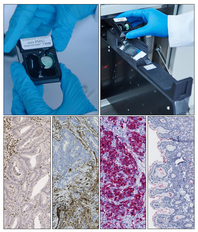 Gloved hands handle a slide cartridge; another cartridge is loaded into a machine. Below are four stained tissue sample images under a microscope, each showing different staining patterns.