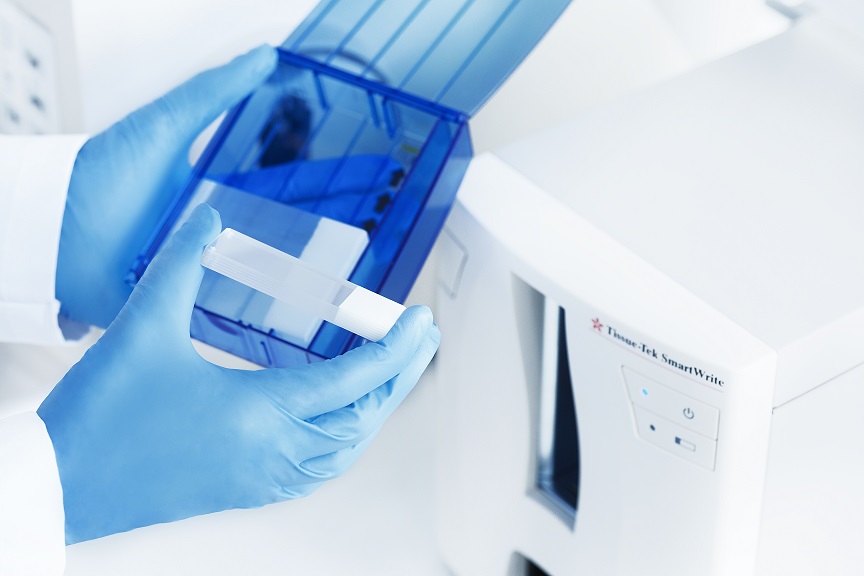 A person wearing blue gloves holds a sample container near a medical laboratory analyzer with an open blue lid.