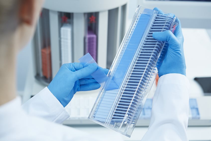 A person in a lab coat and blue gloves places a cover slip on a tray filled with microscope slides in a laboratory setting.