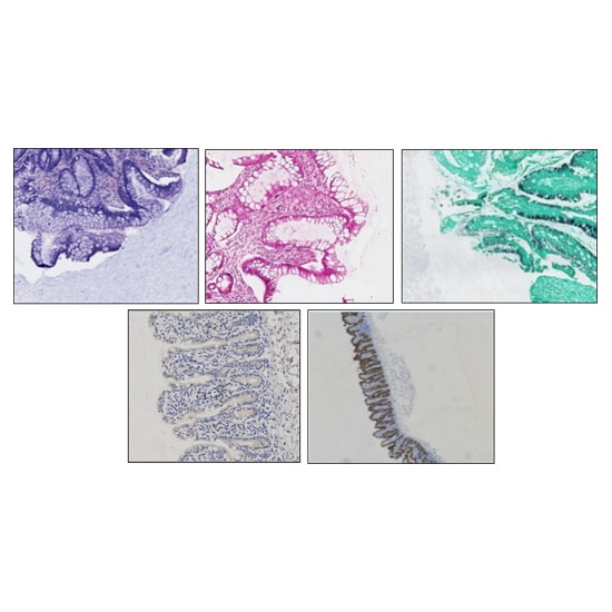 Five microscopic images of tissue samples, each stained with different dyes, showing various structural patterns and cellular organization.