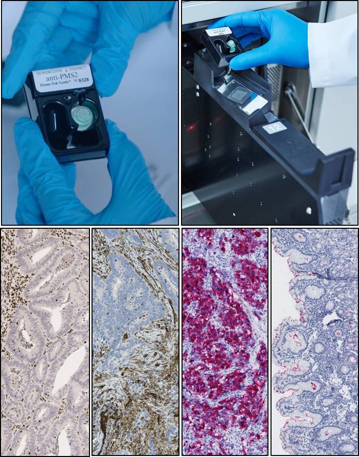 Gloved hands handle labeled reagent cartridges; bottom panels show stained tissue samples under a microscope, demonstrating various patterns and colors.