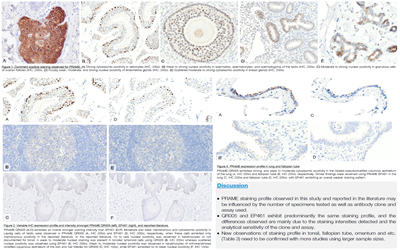 Immunohistochemical Expression Profiles of PRAME in Human Normal FFPE Tissue Spe…