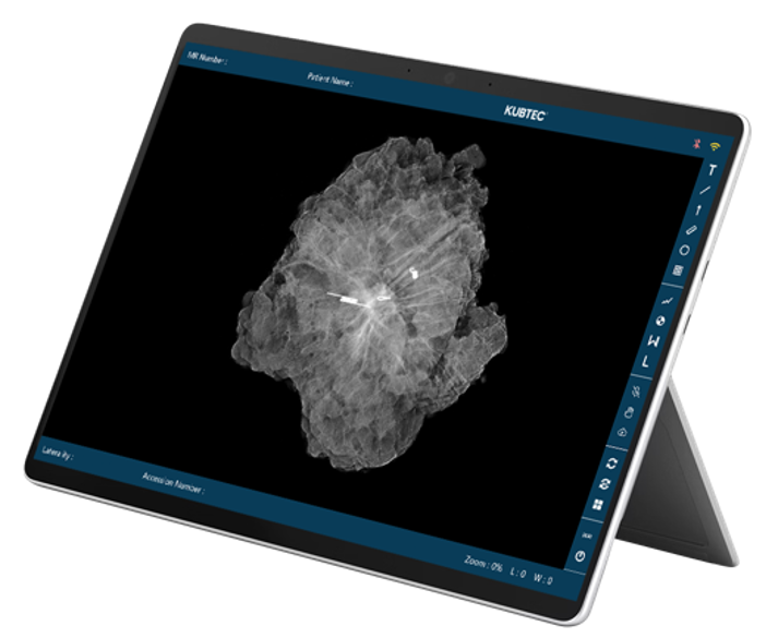 A tablet displays a grayscale medical scan image on its screen, showing a translucent anatomical structure with measurement markers.