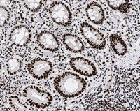 Microscopic image showing cross-sections of glandular tissue with dark-stained cell nuclei arranged around circular and oval-shaped structures.