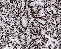 A close-up of a cell.