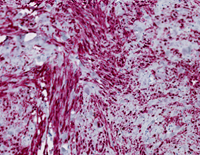 A close-up of a microscope.