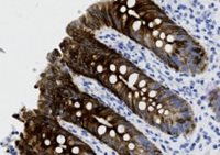 Microscopic image of stained intestinal tissue showing dark brown villi structures and scattered blue-stained nuclei.