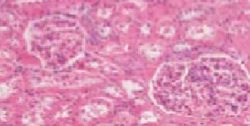 Microscopic image of kidney tissue showing glomeruli and tubules stained with pink and purple hues.