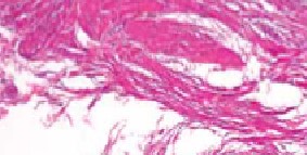 Microscopic image showing pink-stained fibrous connective tissue with wavy collagen fibers and scattered white spaces.