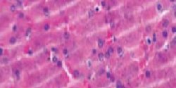 Microscopic view of pink-stained muscle tissue with visible striations and scattered dark purple nuclei.