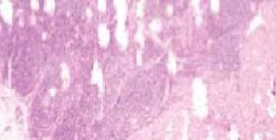 Microscopic view of pink and purple stained tissue sample showing various cell structures and white spaces.