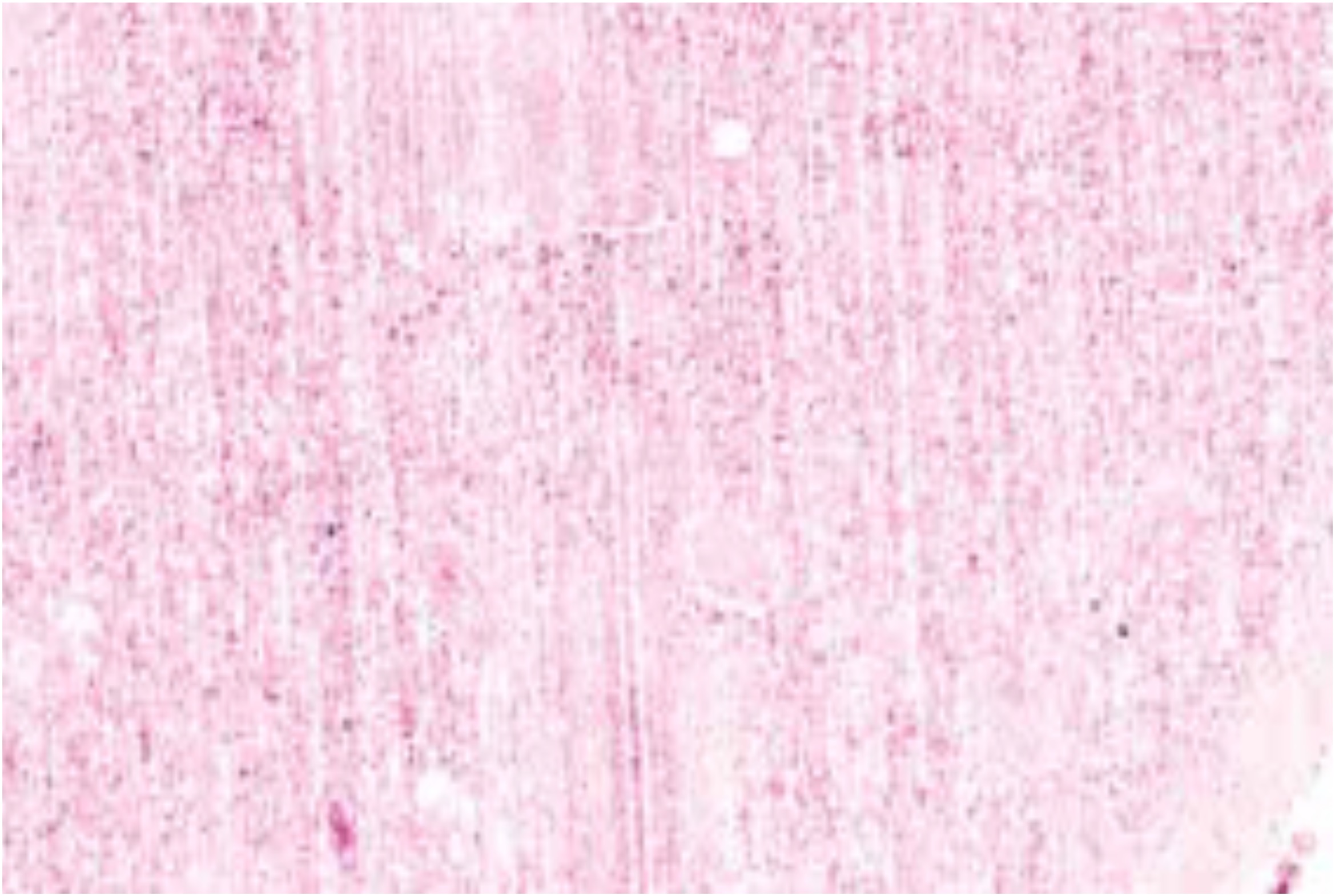 Microscopic view of a tissue sample stained in shades of pink, showing scattered cells and fibrous structures throughout the image.