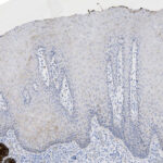 Microscopic image of a tissue section showing multiple layers of cells with some brown-stained areas on the left side and predominantly blue-stained nuclei throughout.