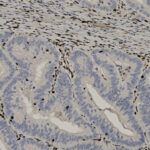 Microscopic image of tissue section stained to show cell nuclei in brown and cytoplasm in light blue, highlighting cellular and structural details.