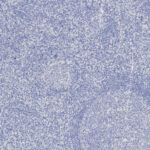 Microscopic view of tissue sample stained in shades of blue and white, showing cellular structures and various densities throughout the image.