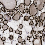 Microscopic view of thyroid gland tissue showing follicles surrounded by follicular cells, stained for cellular detail.