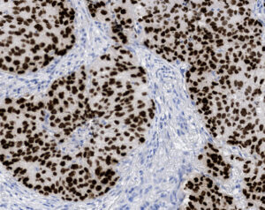 Tissue-Tek Genie<sup>&reg;</sup> anti-Thyroid Transcription Factor-1