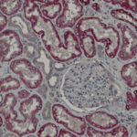 Microscopic image of kidney tissue showing glomerulus and surrounding tubules, stained to highlight cellular structures in pink, gray, and blue.