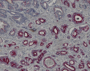 Tissue-Tek Genie<sup>&reg;</sup> DUO anti-AMACR/p63/CK5/6 PIN Antibody Cocktail
