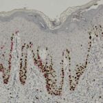 Microscopic image of human skin tissue showing layers of cells with numerous dark-stained nuclei, indicating cell proliferation or activity in the basal and lower epidermal layers.